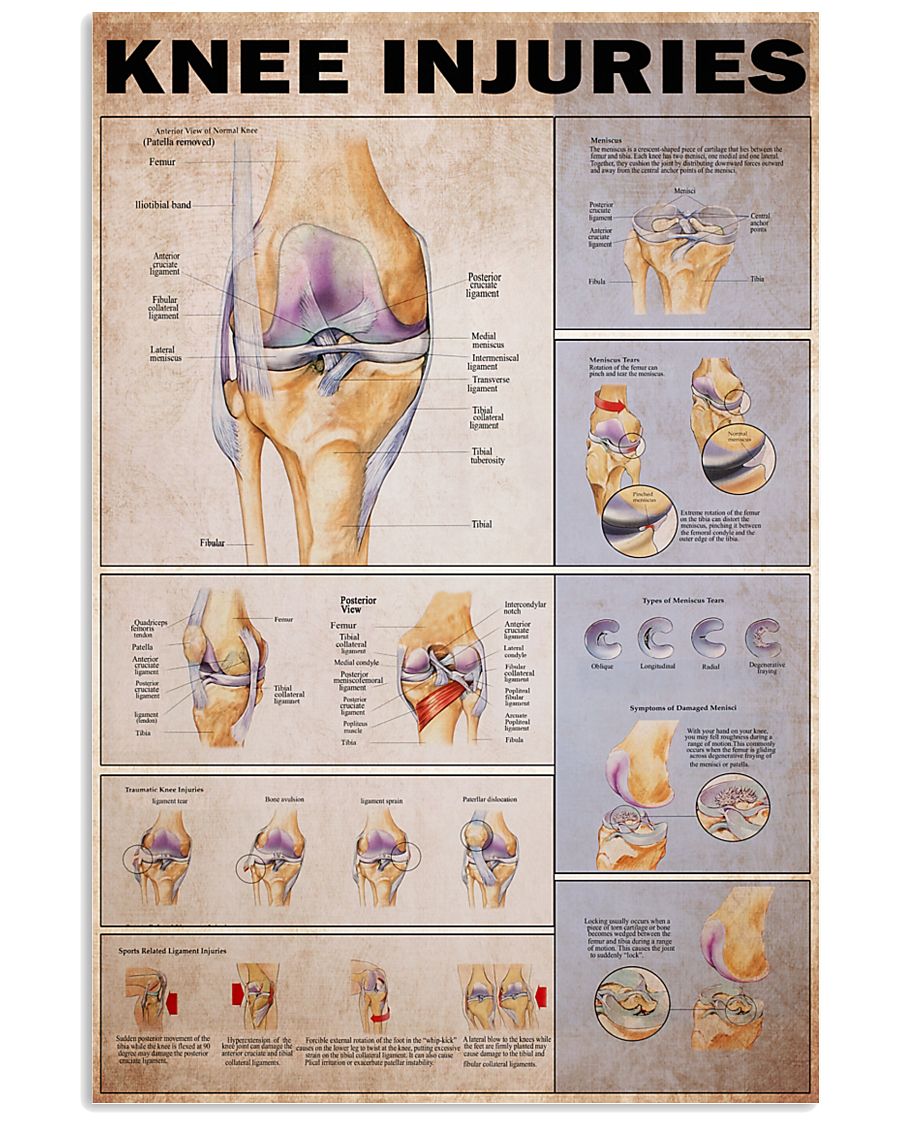 Knees injuries 24x36 Poster