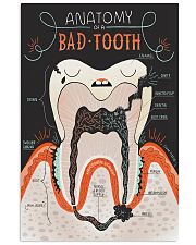 anatomy tooth anatomy bad tooth 2 11x17 Poster front
