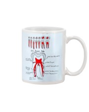 dent antm doodle Mug tile