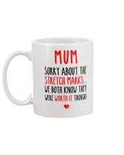 Sorry About The Stretch Marks Mug back