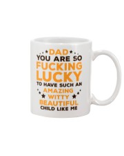 Lucky To Have Mug front