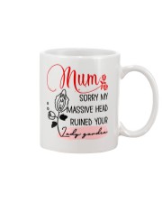 Sorry For Massive Head Mug front