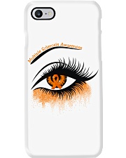 Limited Edition Phone Case tile