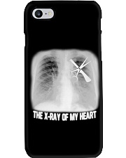 The x-ray of my heart Phone Case tile