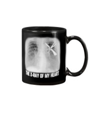 The x-ray of my heart Mug tile