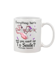 Every thing hurts Mug tile