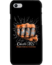 Crush MS Phone Case tile