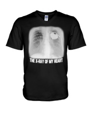 The x-ray of my heart V-Neck T-Shirt tile