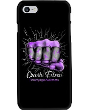 Crush Fibro Phone Case tile