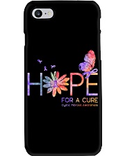 Limited Edition Phone Case tile