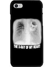 The x-ray of my heart Phone Case tile