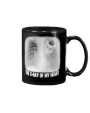 The x-ray of my heart Mug tile