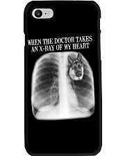 German Shepherd X-ray Of My Heart Phone Case thumbnail