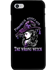 Fibromyalgia messed Phone Case tile